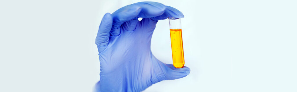 fighting covid 19 using donated blood